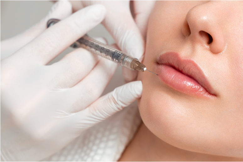 Woman receiving a lip filler injection at a modern aesthetics clinic to enhance lip volume